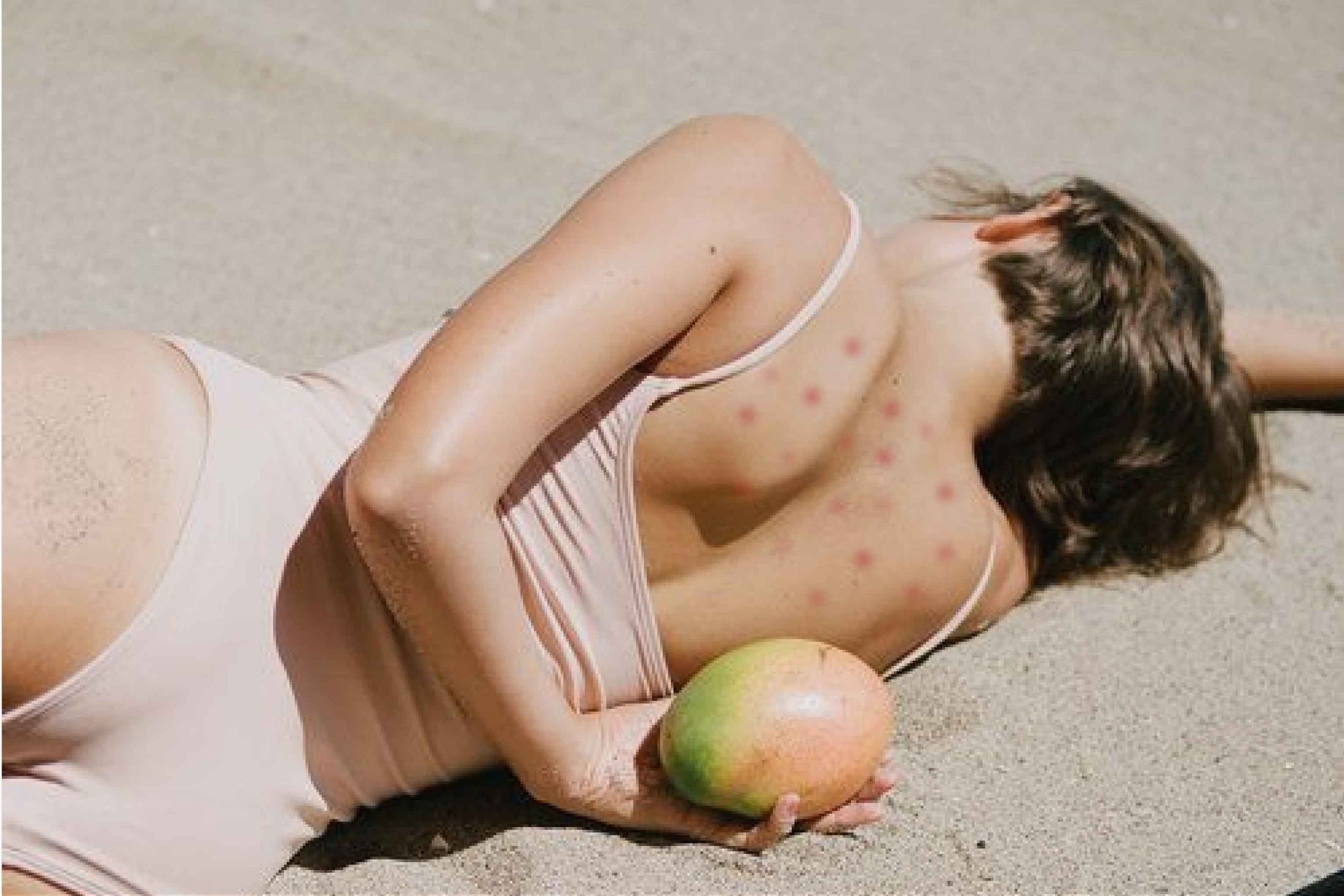BYE BYE BODY ACNE