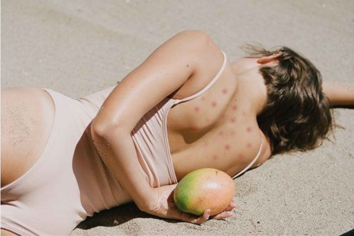 BYE BYE BODY ACNE