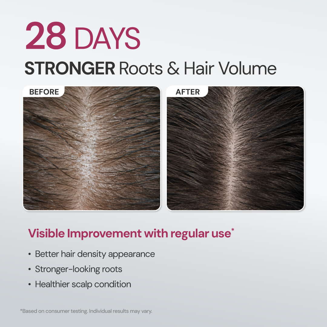 [COMING SOON] Treatment Root Booster Rebalancing Scalp Tonic 100ml